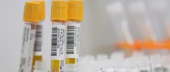 Covid Emilia, oggi 464 contagi e 6 morti: bollettino 20 maggio