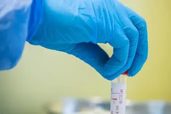 Farmaci sottocutanei emofilia, ematologa: \"Efficaci ma poca esperienza su episodi emorragici\"