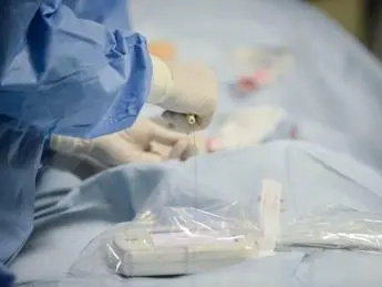 Allarme chirurghi: \"Siamo rimasti in 7mila, difficile recuperare interventi rimandati\"