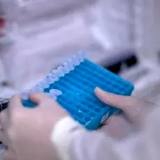 Covid, scoperti nuovi anticorpi in grado di inibire l'infezione