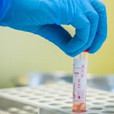 Covid oggi Basilicata, 28 contagi e 1 morto: bollettino 15 giugno