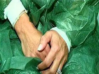 mieloma multiplo, con Car-T sopravvivenza supera i 2 anni