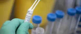 Covid Friuli, due nuovi contagi e zero morti: bollettino 21 giugno