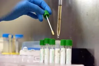 Variante Delta, Rasi: \"Colpisce di più under 30, vaccinare giovani\"