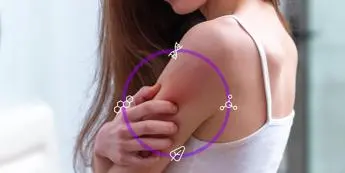 Farmaci, AbbVie: 'Ok Chmp Ema per anti-dermatite atopica da moderata a grave'