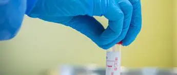 Covid oggi Emilia Romagna, 64 contagi e un morto: bollettino 28 giugno