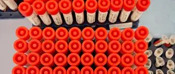 Covid Piemonte, 31 contagi e nessun decesso: bollettino 7 luglio