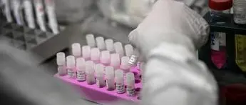 Covid oggi Veneto, 80 contagi: bollettino 7 luglio