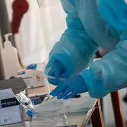 Covid Lombardia: oggi 100 contagi e nessun morto: bollettino 7 luglio