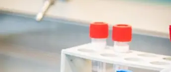 Covid Abruzzo, cluster familiare con 11 positivi a Lanciano: accertata variante Delta