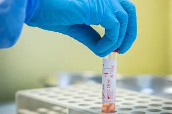 Covid, contagi in crescita in Italia: tasso positività vicino all'1%