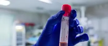 Covid oggi Basilicata, 11 contagi e zero morti: bollettino 19 luglio