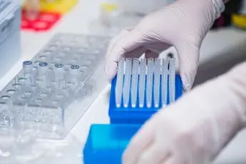 Cancro, test sangue per diagnosi precoce su 50 tumori