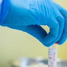 Covid oggi Abruzzo: 93 contagi e nessun decesso: bollettino 15 settembre