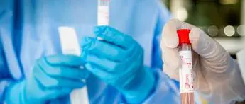 Covid oggi Abruzzo, 49 contagi e un decesso: bollettino 25 settembre