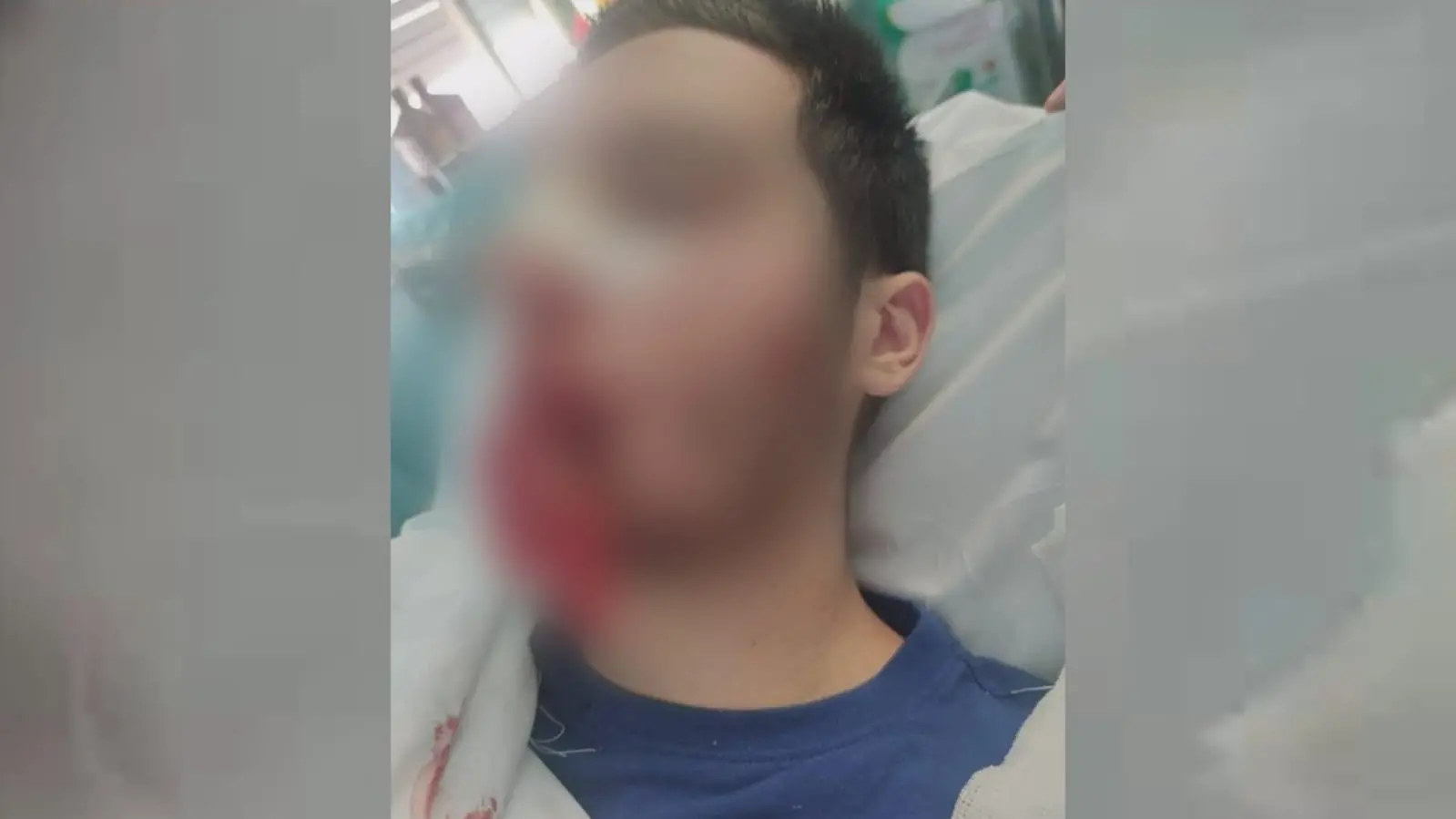 Minore aggredito a Castrolibero, \"è stato nostro figlio, ci è crollato il mondo addosso\"