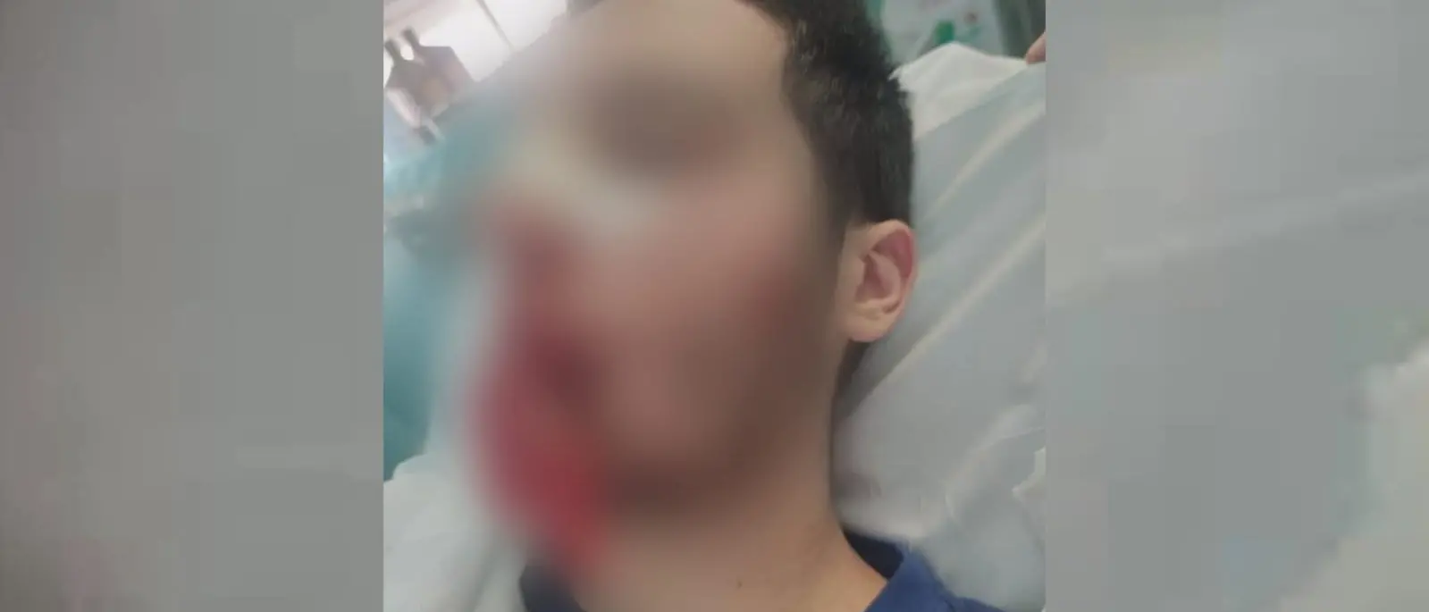 Minore aggredito a Castrolibero, \"è stato nostro figlio, ci è crollato il mondo addosso\"