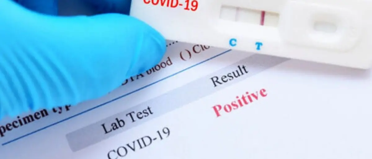 Covid Italia, bollettino del 29 gennaio: 137.147 contagi e 377 morti