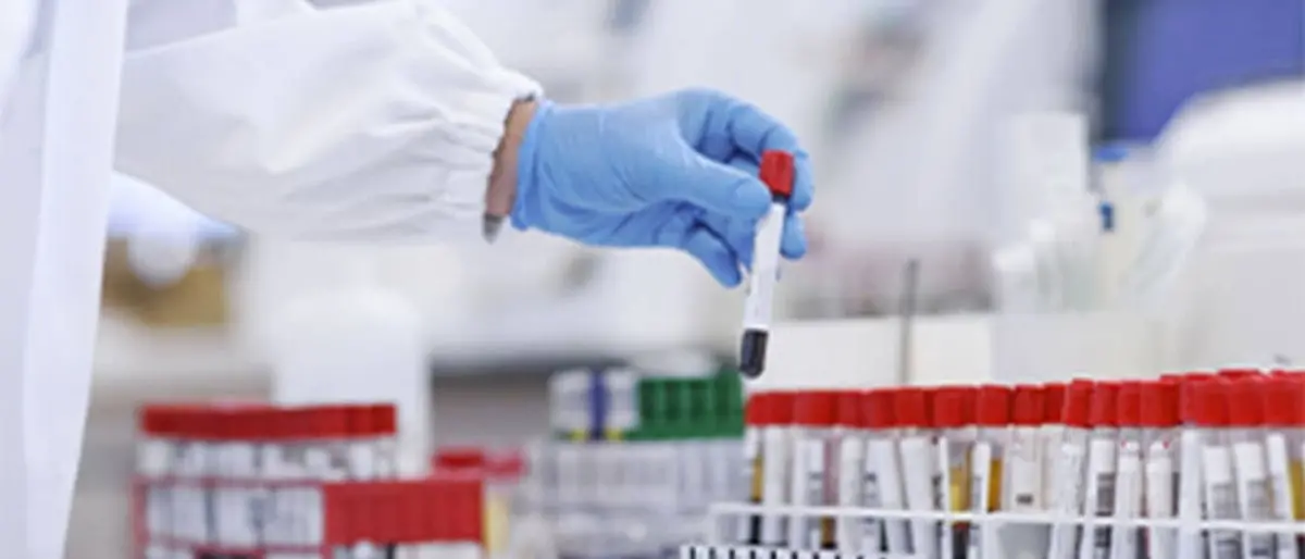 Covid Italia, bollettino del 10 marzo: 54.230 contagi e 136 morti