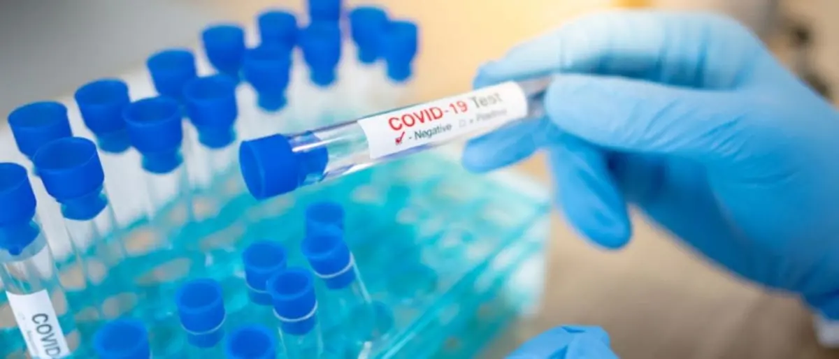 Covid Italia, 74.024 contagi. Calano i decessi: bollettino del 19 marzo