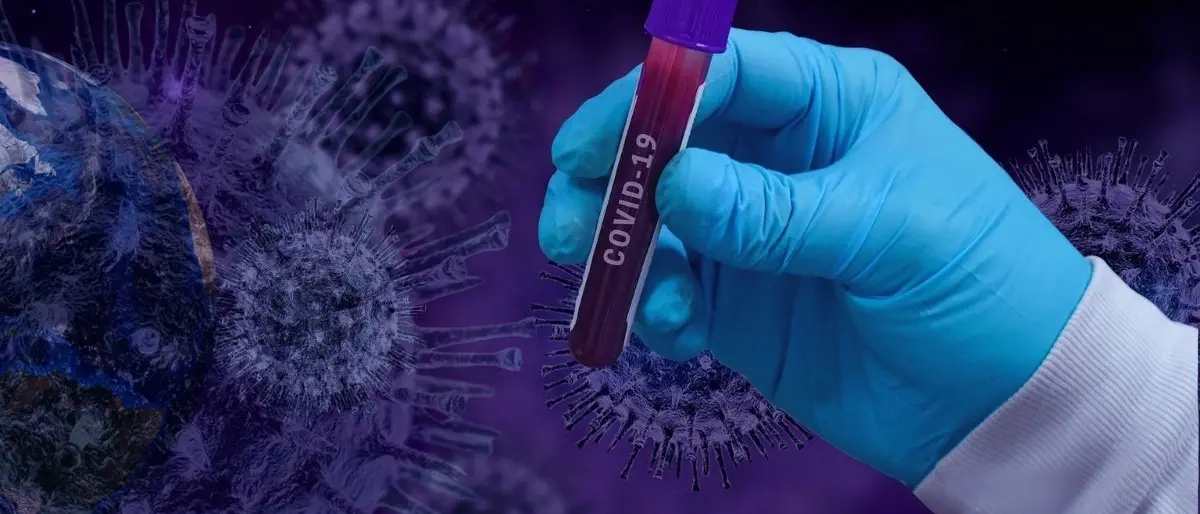 Covid Italia, 75.616 contagi e 146 morti: bollettino del 25 marzo