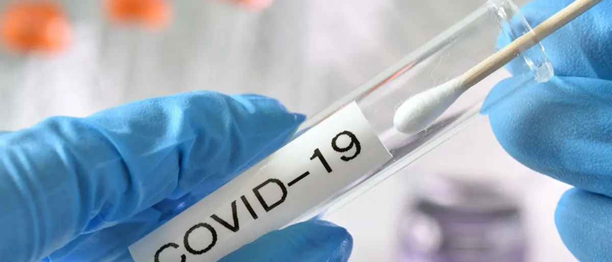 Covid Italia, 17.647 contagi e 41 decessi: bollettino del 28 agosto