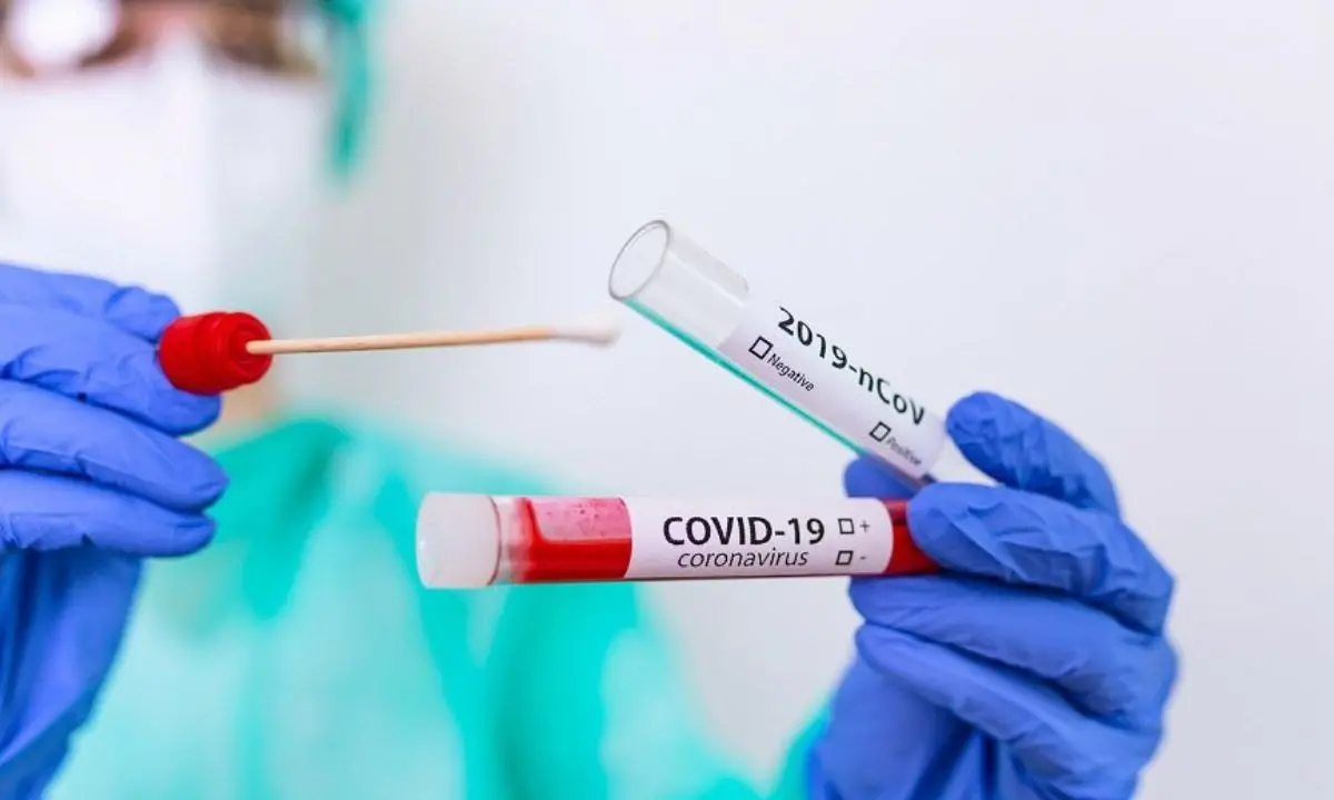 Covid, risale la curva dei contagi in Italia e i decessi aumentano di quasi il 10%