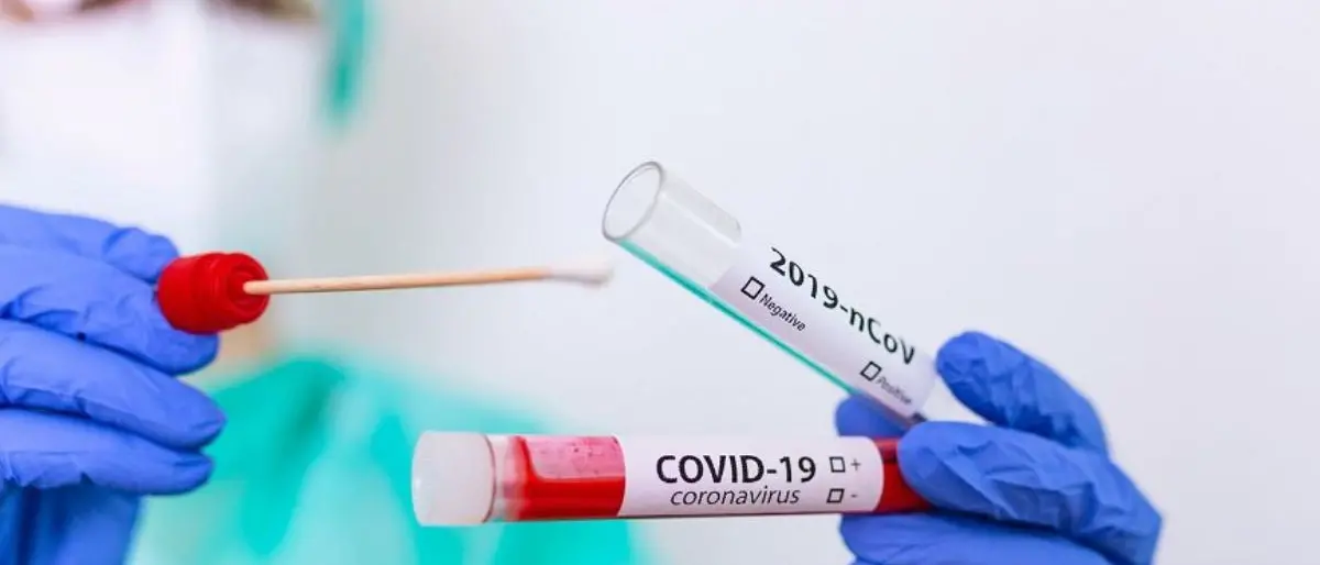 Covid Italia, 44.672 casi e 62 decessi: bollettino del 7 ottobre