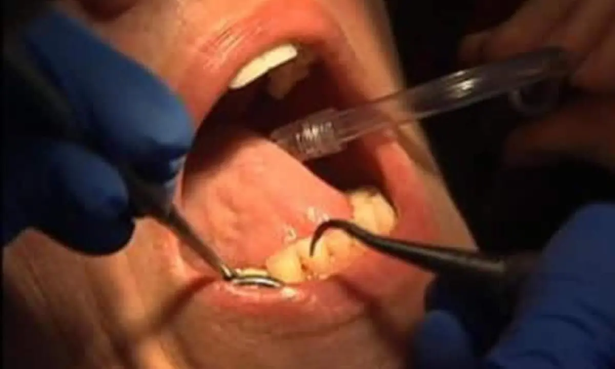 Un dentista cosentino fra le vittime del clan Bellocco di Rosarno