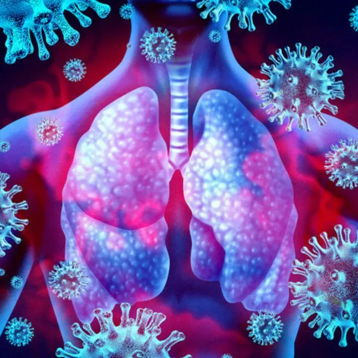 Covid, con asma grave si è più a rischio, ma vaccino protegge bene