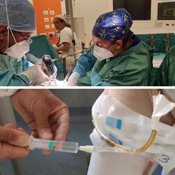 Tumore all’intestino, intervento innovativo a Cosenza su un paziente di 60 anni