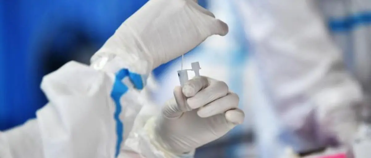 Covid Italia, 79.920 contagi e 44 decessi: bollettino del 10 luglio