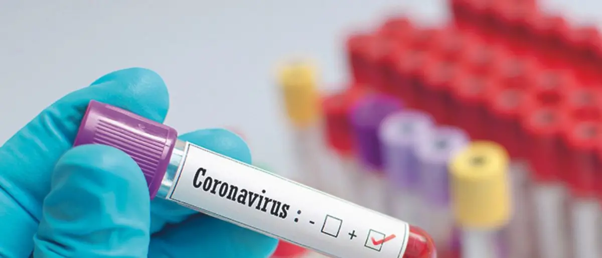 Covid Italia, 120.683 contagi e 176 morti: bollettino del 19 luglio