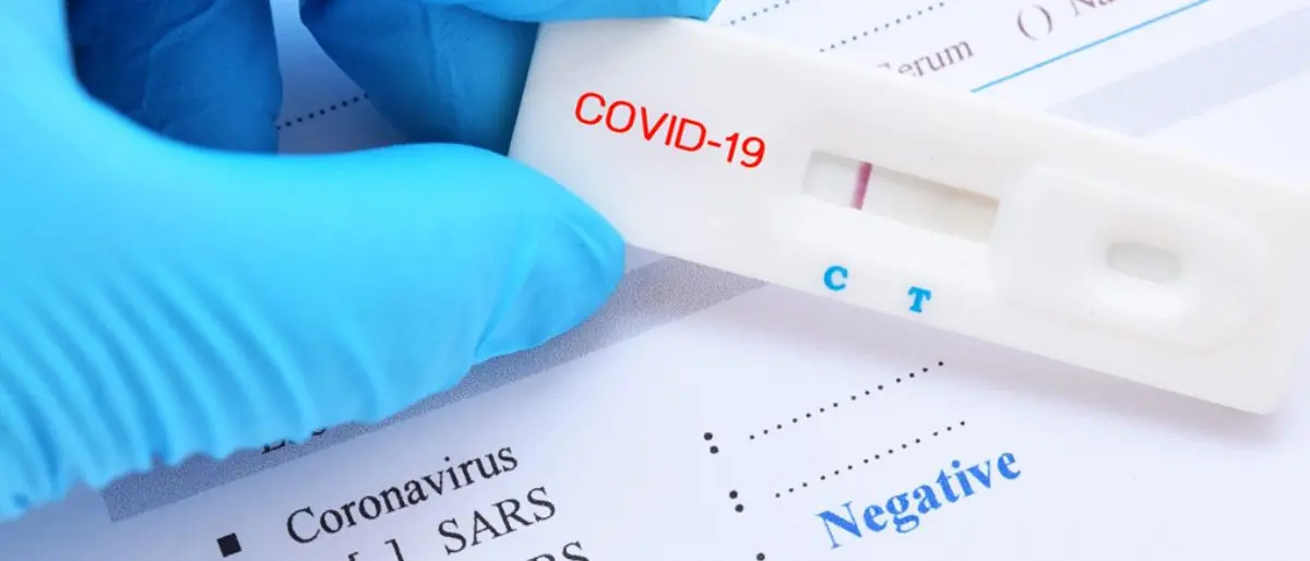 Covid Italia, diminuiscono contagi e morti: bollettino del 31 luglio