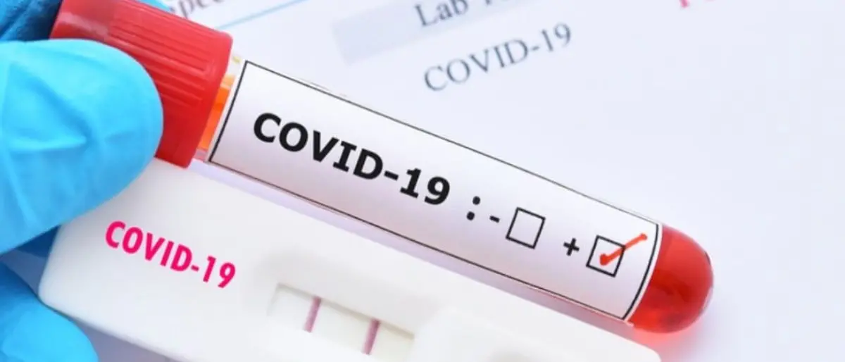 Covid Italia, 49.571 contagi e 121 decessi: bollettino del 30 luglio