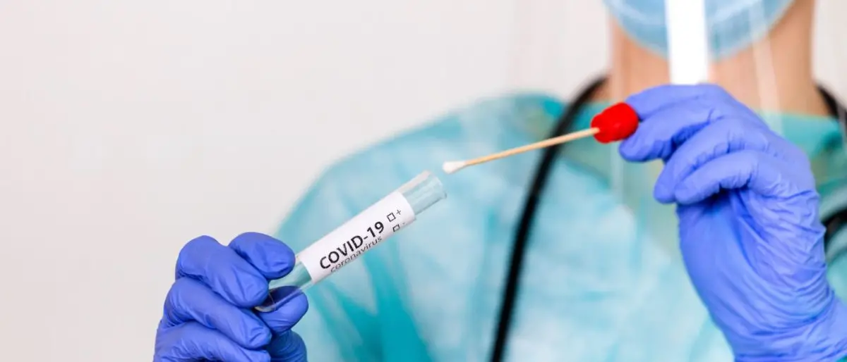 Covid Italia, diminuiscono i contagi e i morti: bollettino del 3 agosto