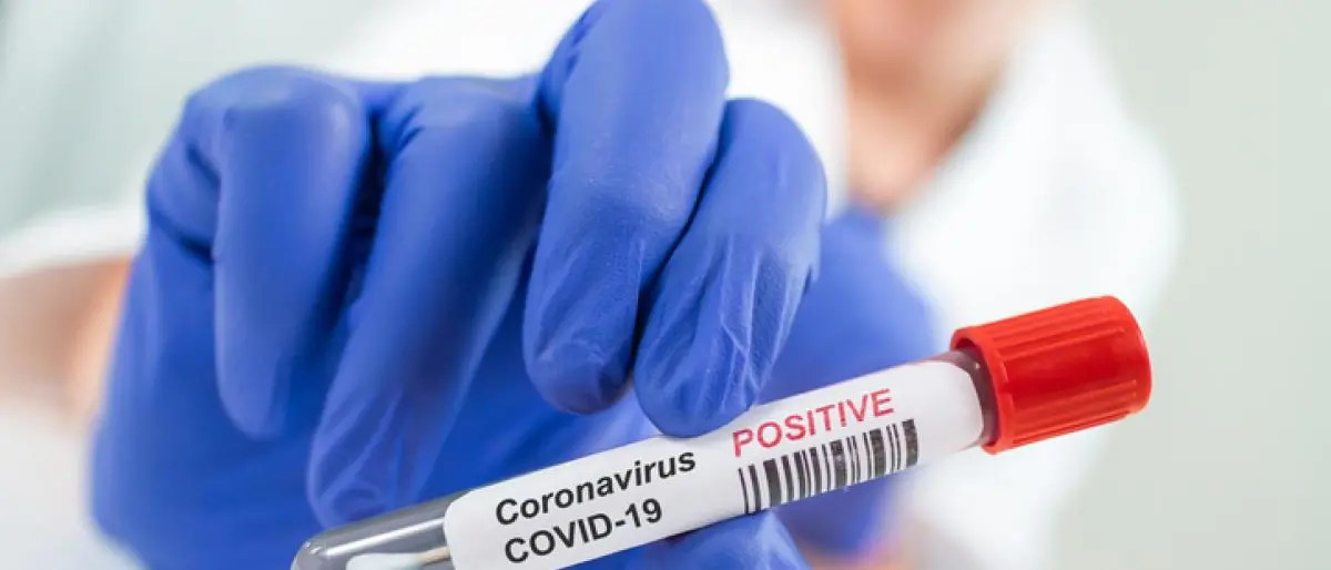 Covid Italia, 27.296 contagi e 147 morti: bollettino del 18 agosto