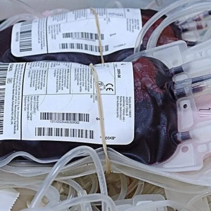 Scalea, la Fidas comunica la sospensione della raccolta di sangue per mancanza di fondi