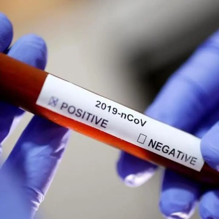 Covid Italia, 17.574 contagi e 57 morti: bollettino del 7 settembre