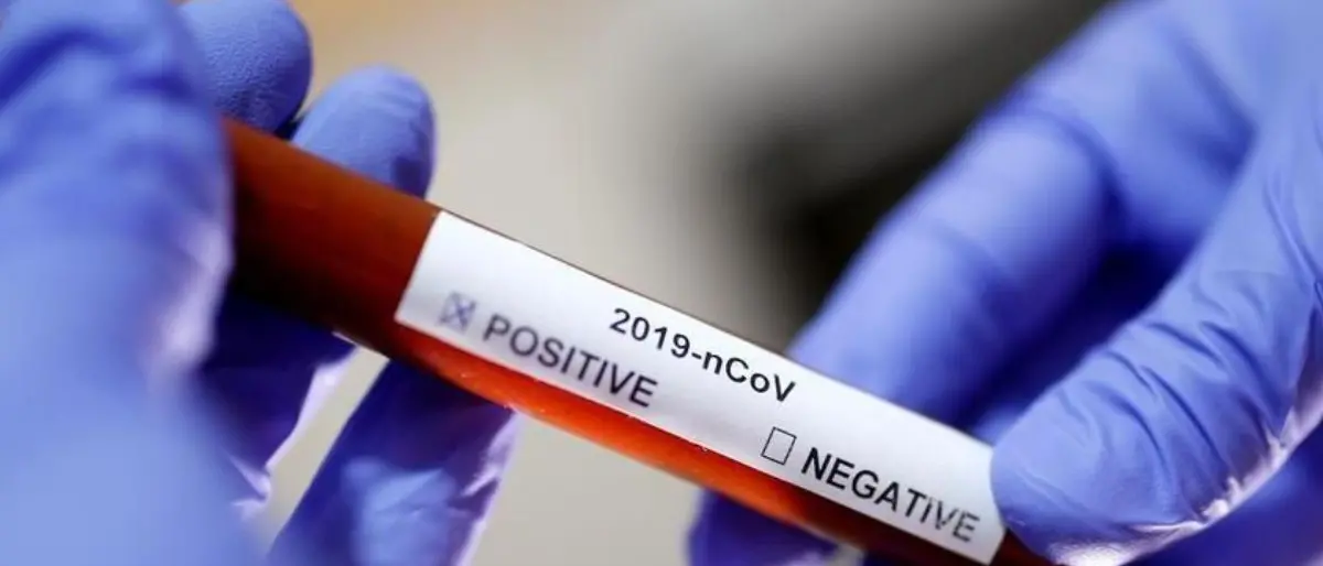 Covid Italia, 17.574 contagi e 57 morti: bollettino del 7 settembre