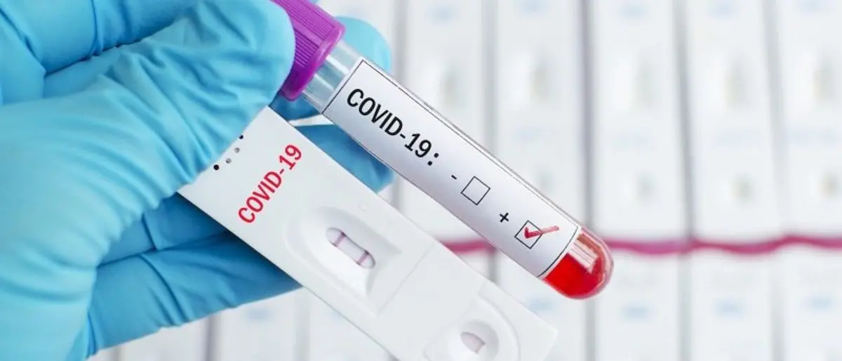 Covid Italia, 22.527 contagi e 60 morti: bollettino del 22 settembre