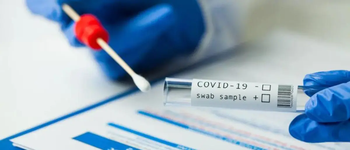 Covid Italia, 58.360 contagi e 113 morti: bollettino del 18 ottobre