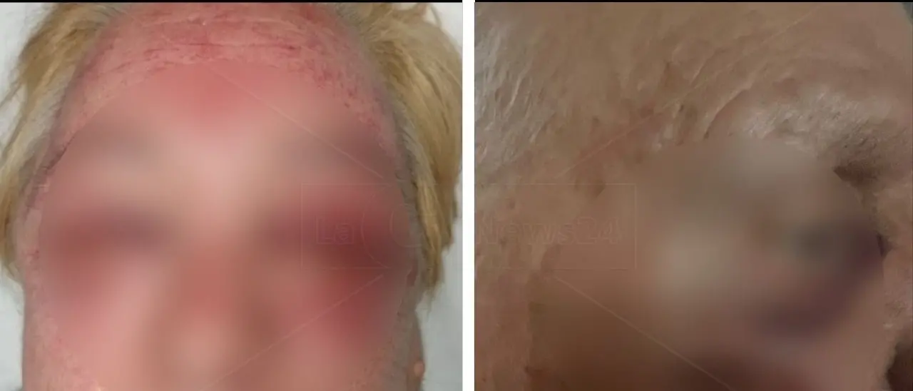 Aggrediti in casa a colpi di bastone: all'origine del gesto forse una lite con i vicini