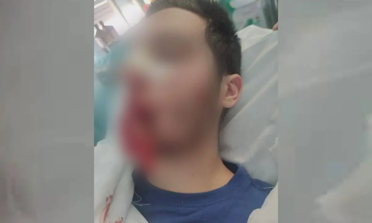 Studente aggredito a Castrolibero, fissata l'udienza preliminare