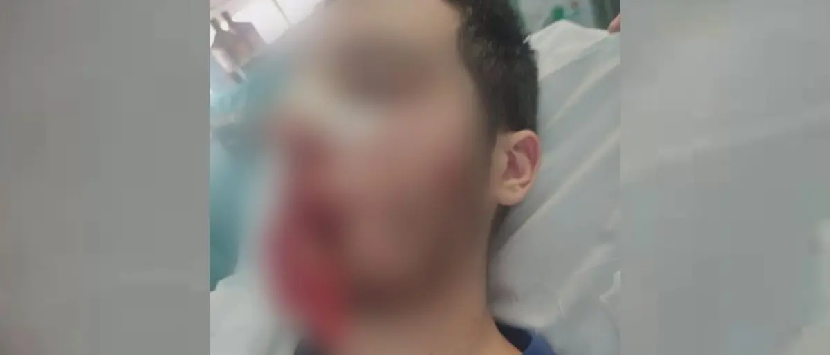 Studente aggredito a Castrolibero, fissata l'udienza preliminare