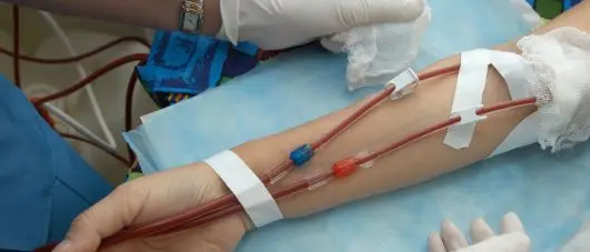 Dialisi, il sindaco di Cosenza Caruso: «Locali più moderni grazie all'accordo con l'Asp»