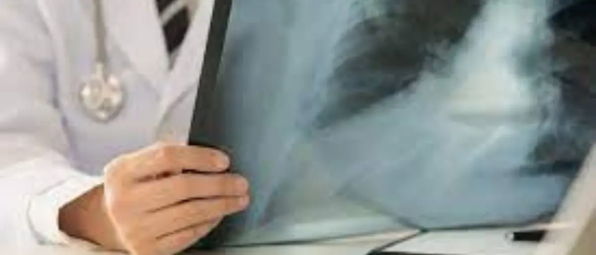 Casi di polmoniti nei bambini: preoccupa la resistenza dagli antibiotici