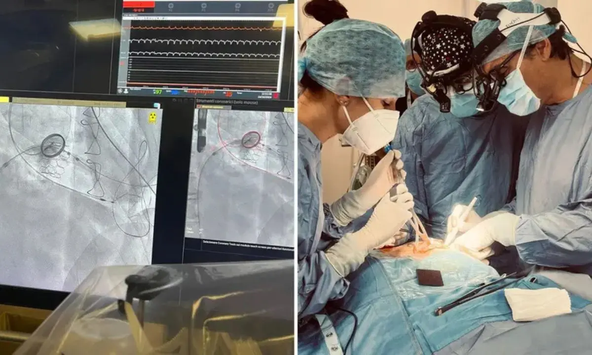 Intervento al cuore ad alto rischio, ma non per medico calabrese Giuseppe Nasso