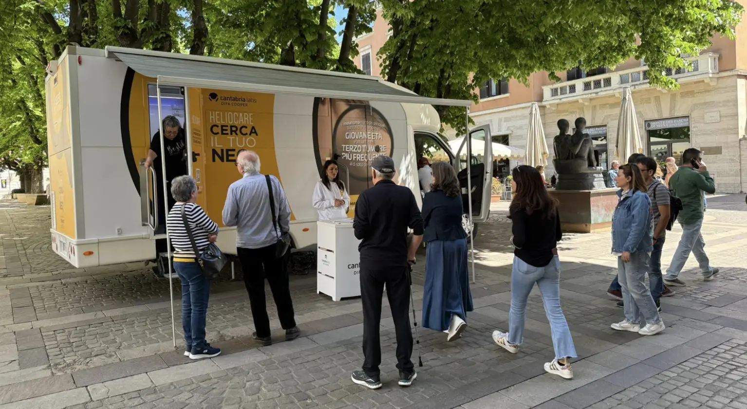 Lotta al melanoma, Cosenza unica tappa del tour di prevenzione e sensibilizzazione