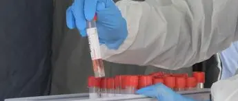 Covid oggi Emilia Romagna, 365 contagi: bollettino 3 agosto